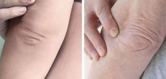 تعرفوا إلى 7 أجزاء في الجسم تكشف عن التقدم في العمر..! صورة رقم 3