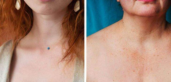 تعرفوا إلى 7 أجزاء في الجسم تكشف عن التقدم في العمر..! صورة رقم 4