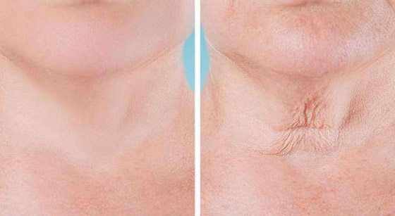 تعرفوا إلى 7 أجزاء في الجسم تكشف عن التقدم في العمر..! صورة رقم 5