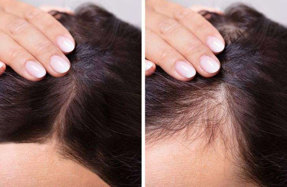 تعرفوا إلى 7 أجزاء في الجسم تكشف عن التقدم في العمر..! صورة رقم 6