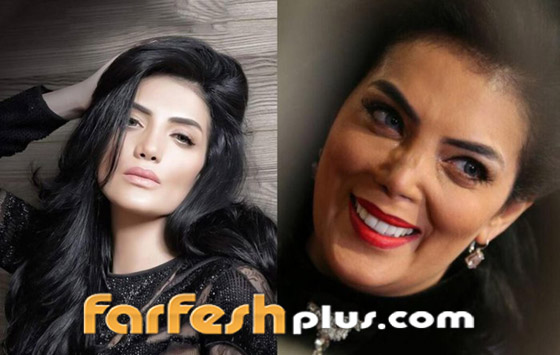 صور: كيف أفسدت عمليات التجميل شكل هؤلاء النجمات وخسرن الشهرة فجأة؟ صورة رقم 1