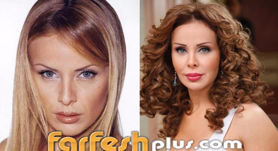 صور: كيف أفسدت عمليات التجميل شكل هؤلاء النجمات وخسرن الشهرة فجأة؟ صورة رقم 5