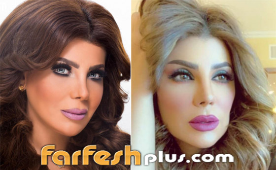 صور: كيف أفسدت عمليات التجميل شكل هؤلاء النجمات وخسرن الشهرة فجأة؟ صورة رقم 10