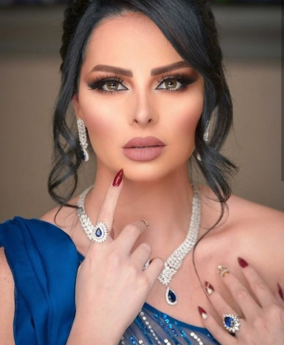 ديانا كرزون لأفيخاي أدرعي : ” لا يشرفني متابعتك الي “ صورة رقم 2