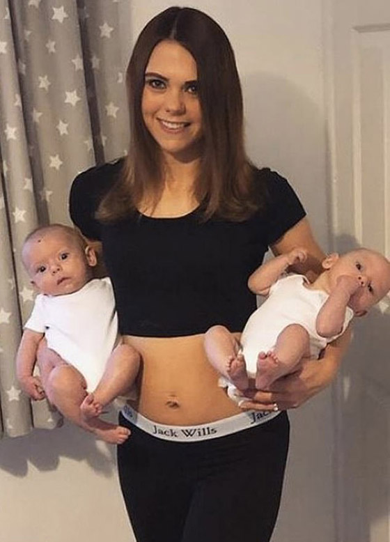 بحالة نادرة لأول مرة.. بريطانية تلد توأمين متماثلين بيومين وكيسين مختلفين! صورة رقم 3