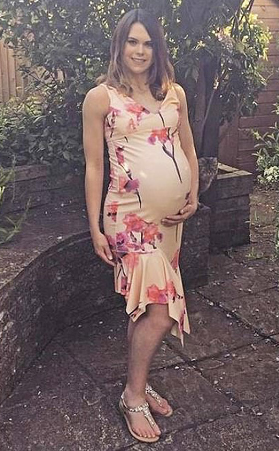 بحالة نادرة لأول مرة.. بريطانية تلد توأمين متماثلين بيومين وكيسين مختلفين! صورة رقم 4