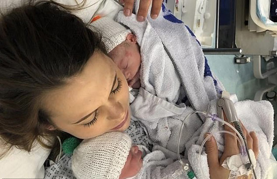 بحالة نادرة لأول مرة.. بريطانية تلد توأمين متماثلين بيومين وكيسين مختلفين! صورة رقم 16