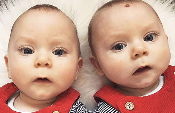 بحالة نادرة لأول مرة.. بريطانية تلد توأمين متماثلين بيومين وكيسين مختلفين! صورة رقم 18