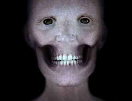 كهرباء المخ.. وأغرب الحقائق عن الجسم البشري صورة رقم 3