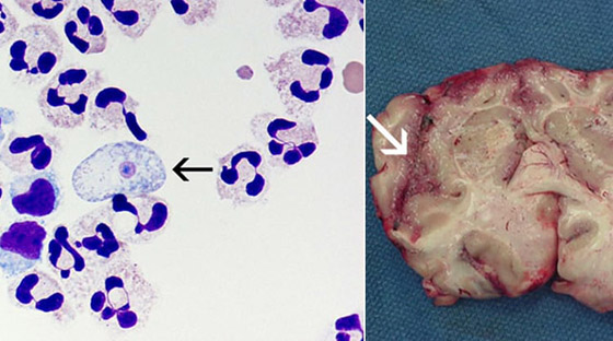 10 طفيليات عجيبة وغريبة ذات طرق مخيفة بالاستيلاء على أجساد مضيفيها صورة رقم 5