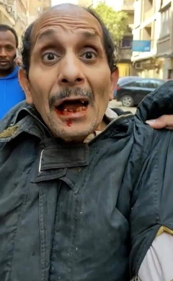 فيديو: فتاة مصرية (جدعة) تلكم متحرش وتسقط بعض أسنانه.. كل الاحترام صورة رقم 3 فيديو: فتاة مصرية (جدعة) تلكم متحرش وتسقط بعض أسنانه.. كل الاحترام صورة رقم 3
