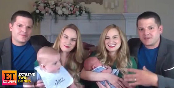 قصة فريدة مميزة لأختين توأم تعيشان حياة متطابقة في كل شيء! صور صورة رقم 1