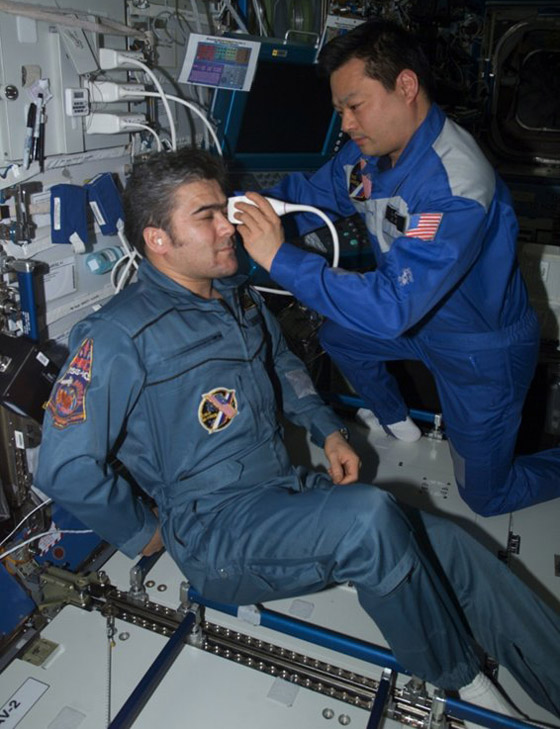 الآثار الجانبية للجاذبية والإشعاع.. كيف تتغير عين الإنسان بعد عام بالفضاء؟ صورة رقم 3