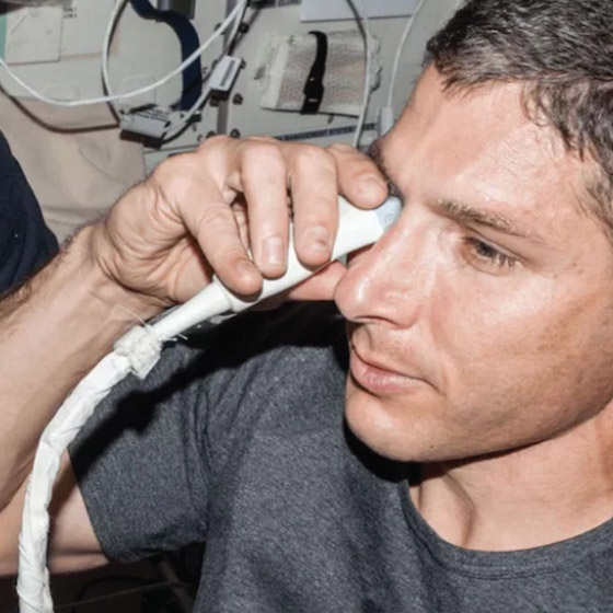 الآثار الجانبية للجاذبية والإشعاع.. كيف تتغير عين الإنسان بعد عام بالفضاء؟ صورة رقم 6