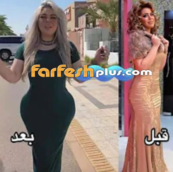 فيديو وصور: هجوم واسع على فنانة سورية بسبب النفخ والتكبير! أصبحت تضاريس جسمها كالإجاصة! صورة رقم 2