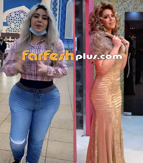 فيديوهات وصور صادمة: مروة راتب بأرداف ضخمة بعد عملية تجميل وتصف جسدها بالنار! صورة رقم 23