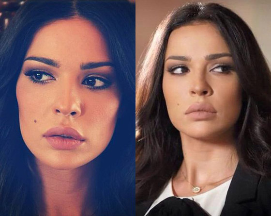صور قديمة لـ نادين نسيب نجيم تصدم الجمهور! الفرق كبير قبل وبعد عمليات التجميل!  صورة رقم 9
