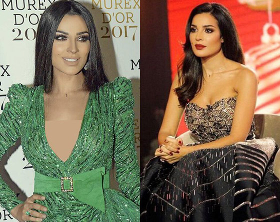 صور قديمة لـ نادين نسيب نجيم تصدم الجمهور! الفرق كبير قبل وبعد عمليات التجميل!  صورة رقم 7