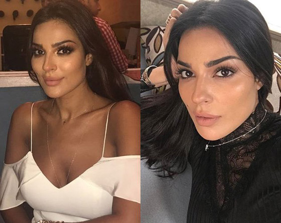 صور قديمة لـ نادين نسيب نجيم تصدم الجمهور! الفرق كبير قبل وبعد عمليات التجميل!  صورة رقم 12