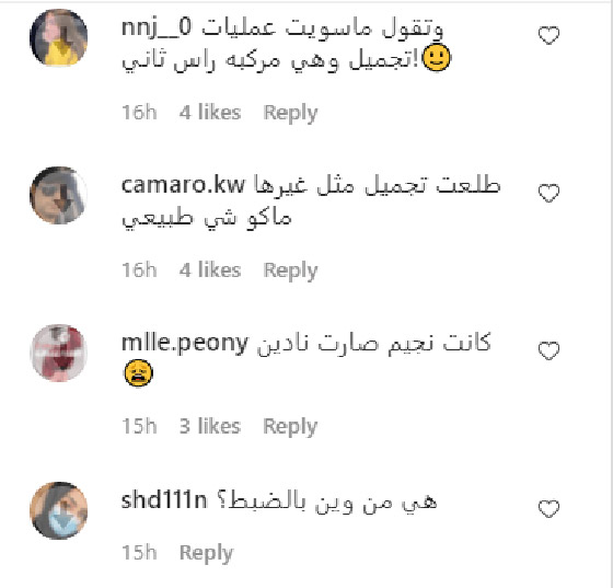 صور قديمة لـ نادين نسيب نجيم تصدم الجمهور! الفرق كبير قبل وبعد عمليات التجميل!  صورة رقم 1