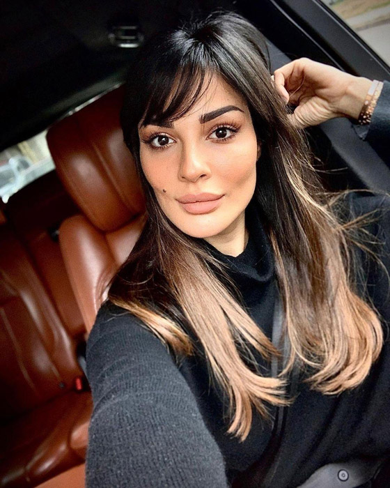 صور قديمة لـ نادين نسيب نجيم تصدم الجمهور! الفرق كبير قبل وبعد عمليات التجميل!  صورة رقم 15