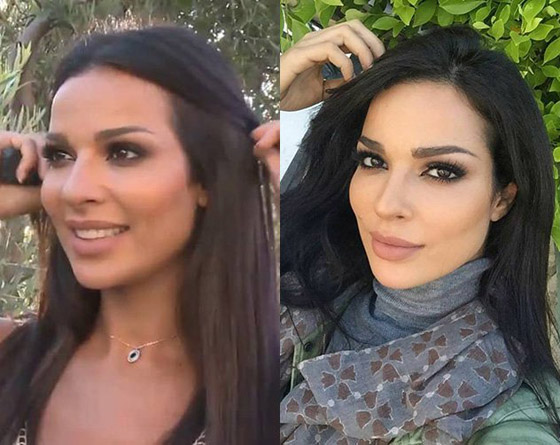 صور قديمة لـ نادين نسيب نجيم تصدم الجمهور! الفرق كبير قبل وبعد عمليات التجميل!  صورة رقم 18