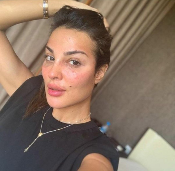 صور قديمة لـ نادين نسيب نجيم تصدم الجمهور! الفرق كبير قبل وبعد عمليات التجميل!  صورة رقم 2