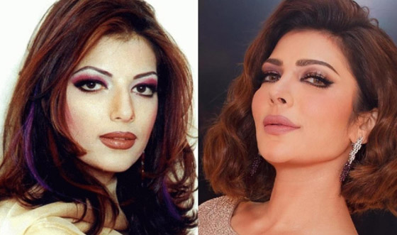 صور فنانات قبل وبعد عملية تجميل الأنف، بينهن نانسي عجرم، نجوى كرم ومي عز الدين صورة رقم 6