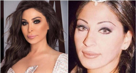 صور فنانات قبل وبعد عملية تجميل الأنف، بينهن نانسي عجرم، نجوى كرم ومي عز الدين صورة رقم 19