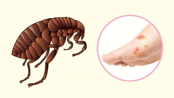 البعوض.. وأشهر الحشرات اللادغة وأعراض الإصابة صورة رقم 6