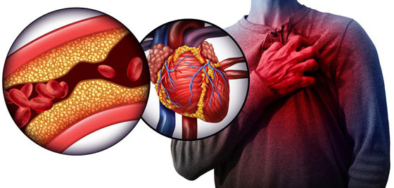 اشربوا المشروب الساخن أثناء الطقس الحار.. 8 حقائق صحية ستذهلكم! صورة رقم 3
