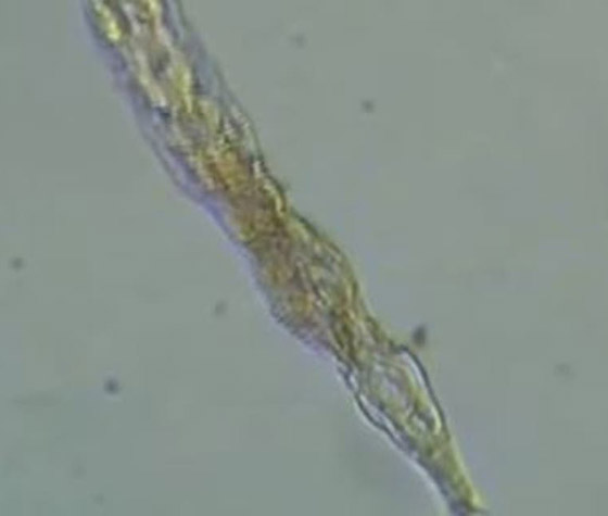 كائن مجهري يعود إلى الحياة بعدما ظل مجمدا 24 ألف سنة! فيديو وصور صورة رقم 4