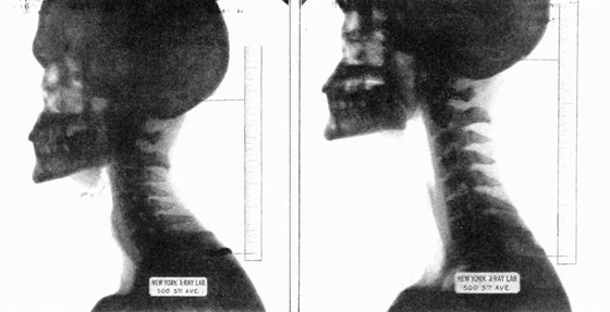 كلارنس ويلارد.. والحالة العجيبة للرجل الذي يتمدد! صورة رقم 5