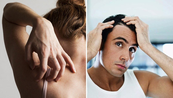 منها تساقط الشعر وآلام المفاصل... أعراض تهدّد المتعافين من كورونا صورة رقم 2