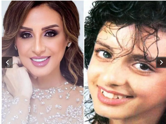 صور قديمة لـ أنغام قبل وبعد عمليات التجميل.. التغيير صادم وهذا هو عمرها الحقيقي! صورة رقم 4