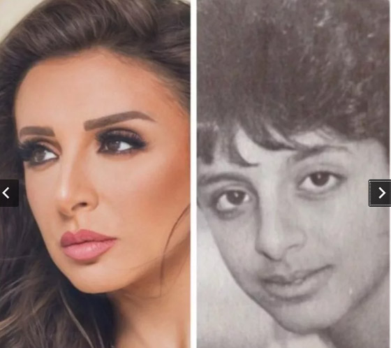 صور قديمة لـ أنغام قبل وبعد عمليات التجميل.. التغيير صادم وهذا هو عمرها الحقيقي! صورة رقم 3