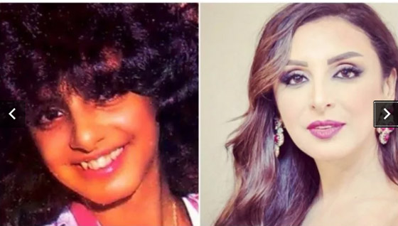 صور قديمة لـ أنغام قبل وبعد عمليات التجميل.. التغيير صادم وهذا هو عمرها الحقيقي! صورة رقم 1