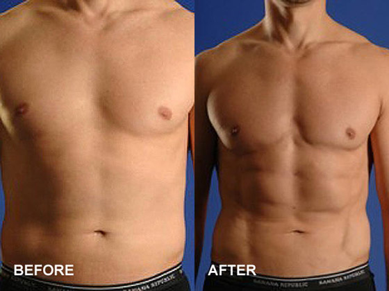 تعديل الأذن لتشبه الجنيات.. إليكم 6 عمليات تجميل مجنونة لم تسمع بها صورة رقم 1 تعديل الأذن لتشبه الجنيات.. إليكم 6 عمليات تجميل مجنونة لم تسمع بها صورة رقم 1