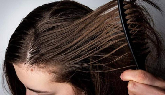مأساة الشعر الدهني بالصيف.. 7 نصائح للتعامل مع فروات الرؤوس المتعرقة صورة رقم 5