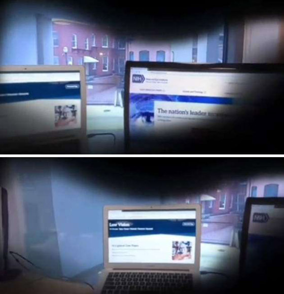 كيف وصف طالب أشهر أمراض العيون بالصور؟ صورة رقم 11