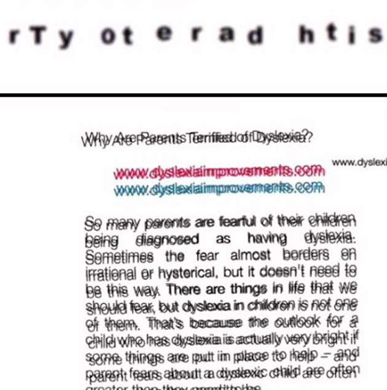 كيف وصف طالب أشهر أمراض العيون بالصور؟ صورة رقم 2