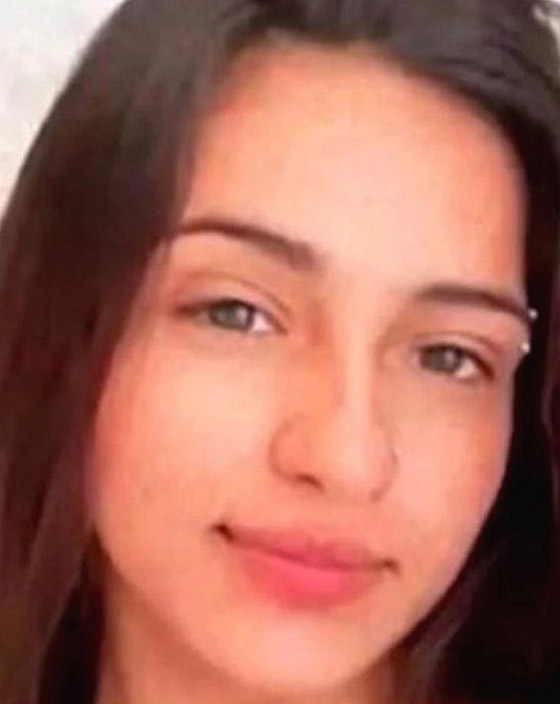 تفارق الحياة بعدوى قاتلة بسبب غرس حلقة في حاجبها صورة رقم 2 تفارق الحياة بعدوى قاتلة بسبب غرس حلقة في حاجبها صورة رقم 2