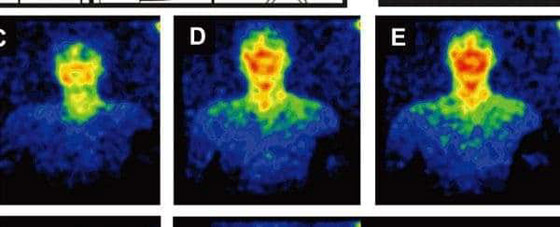 «العظمة العائمة».. وحقائق غريبة عن جسم الإنسان صورة رقم 6