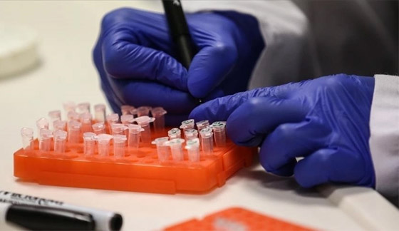 الصين تسجل أول وفاة بشرية بفيروس جدري القردة.. مرض نادر ولا لقاح له صورة رقم 2