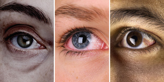 ماذا تقول عيناكم عن صحتكم؟.. 10 علامات تحذركم من أمراض خطيرة صورة رقم 3