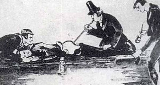 تعرفوا إلى أغرب العلاجات الطبية على مر التاريخ صورة رقم 1