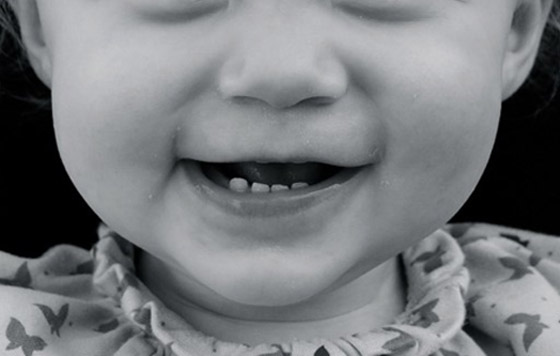 تعرفوا إلى أغرب العلاجات الطبية على مر التاريخ صورة رقم 2