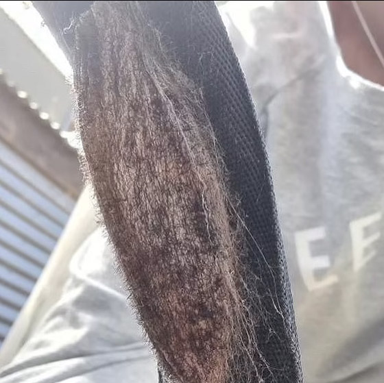 شرنقة شائكة تكاد تقتل طفلاً أثناء لعبه في حديقة المنزل صورة رقم 3