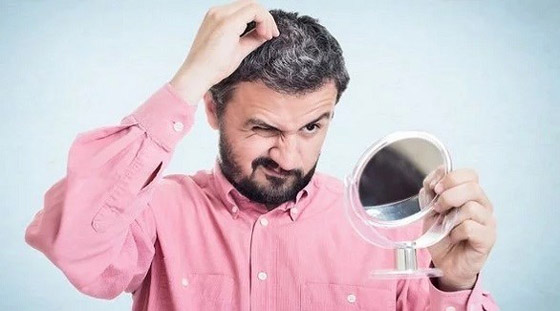 هل يسبب التوتر تحول لون الشعر إلى الرمادي؟ صورة رقم 1