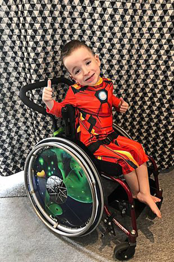 طفل يخاطر بكسر ضلوعه في كل مرة يعطس صورة رقم 3